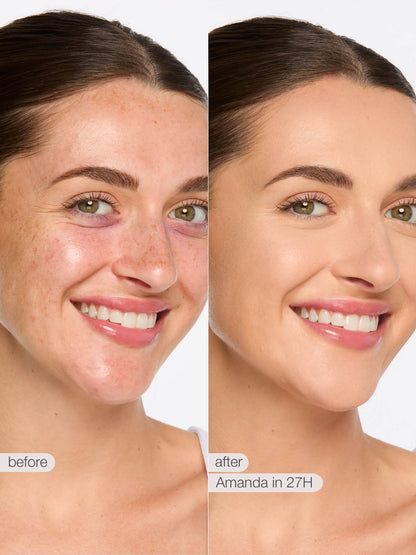 Full-Cover Concealer
